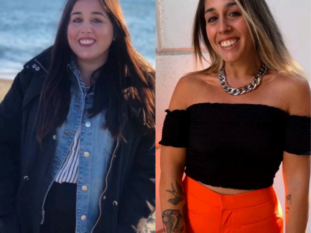 Federica — confronto Prima e Dopo